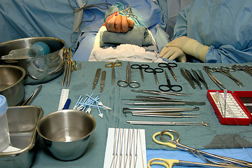 Image showing Surgery-Hand Operation