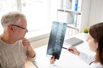 Image showing doctor with spine x-ray and senior man at hospital