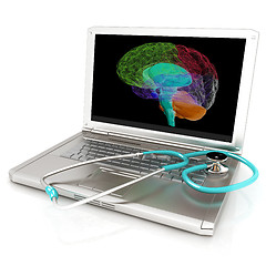 Image showing Laptop, brain and Stethoscope. 3d illustration