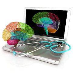 Image showing Laptop, brain and Stethoscope. 3d illustration