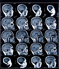 Image showing health medical mri