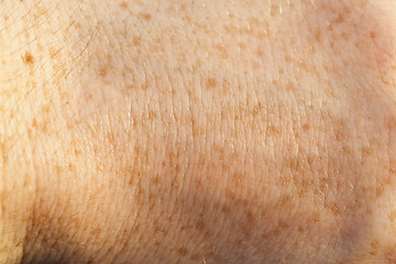 Image showing skin of the human hand