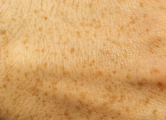 Image showing skin of the human hand