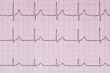 Image showing Printed ECG waves