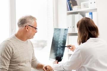 Image showing doctor with spine x-ray and senior man at hospital