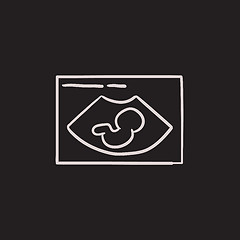 Image showing Fetal ultrasound sketch icon.