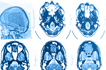 Image showing CT and MRI of the skull