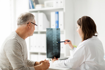 Image showing doctor with spine x-ray and senior man at hospital