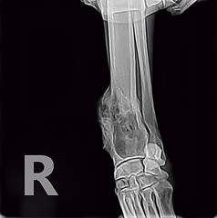 Image showing X-ray of osteosarcoma bone tumor foreleg  a dog.