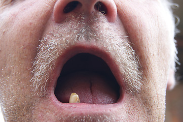 Image showing Man with one teeth