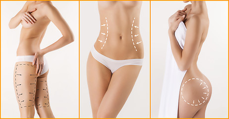 Image showing Body correction with the help of plastic surgery on white background