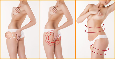 Image showing Body correction with the help of plastic surgery on white background