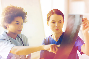 Image showing female doctors with x-ray image at hospital