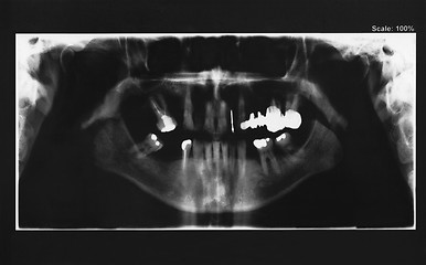 Image showing Dental Xray 