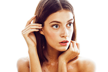 Image showing beautiful young brunette woman with vitiligo disease close up isolated on white positive smiling, model problems concept, bad tan problem