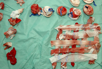 Image showing Surgery-Count is Correct