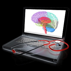 Image showing Laptop, brain and Stethoscope. 3d illustration