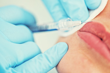 Image showing woman gets injection in her lips