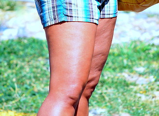 Image showing Cellulite legs.