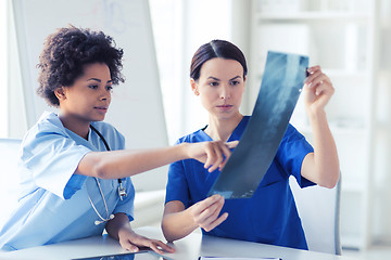 Image showing female doctors with x-ray image at hospital