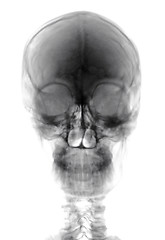 Image showing Human Head Xray Cutout