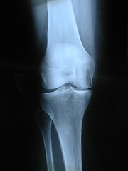 Image showing X-ray