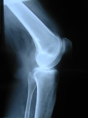 Image showing X-ray