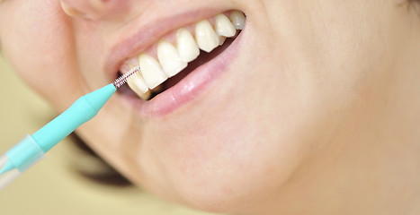 Image showing Teeth with an interdental brush