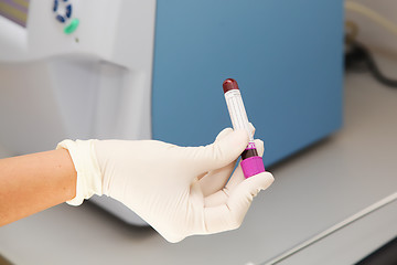 Image showing Blood sample in flask