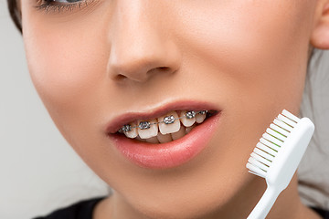 Image showing Beautiful young woman with teeth braces