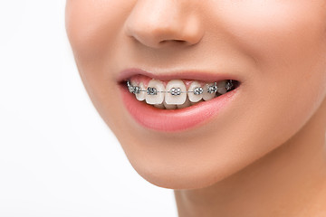 Image showing Beautiful young woman with teeth braces