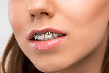 Image showing Beautiful young woman with teeth braces