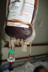 Image showing Blood transfusion