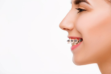 Image showing Beautiful young woman with teeth braces