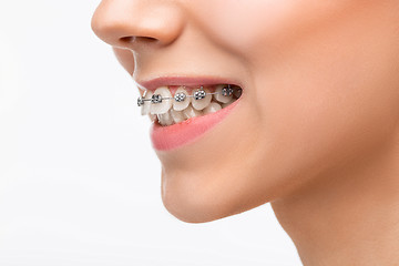 Image showing Beautiful young woman with teeth braces