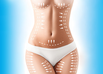 Image showing The cellulite removal plan. White markings on young woman body