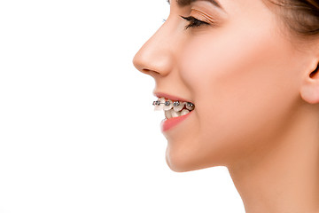 Image showing Beautiful young woman with teeth braces