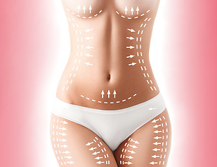 Image showing The cellulite removal plan. White markings on young woman body