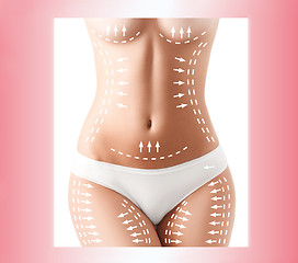 Image showing The cellulite removal plan. White markings on young woman body