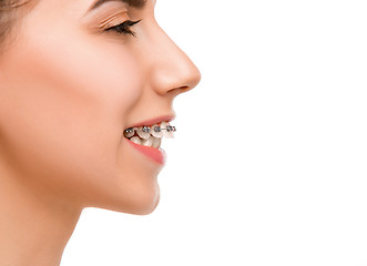 Image showing Beautiful young woman with teeth braces