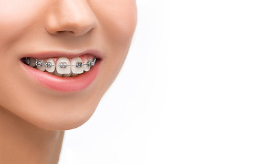 Image showing Beautiful young woman with teeth braces