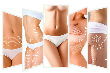 Image showing The cellulite removal plan. White markings on young woman body