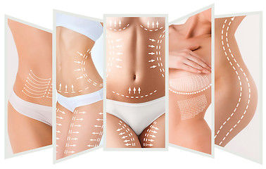 Image showing The cellulite removal plan. White markings on young woman body