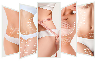 Image showing The cellulite removal plan. White markings on young woman body