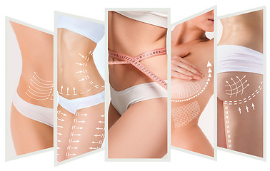 Image showing The cellulite removal plan. White markings on young woman body