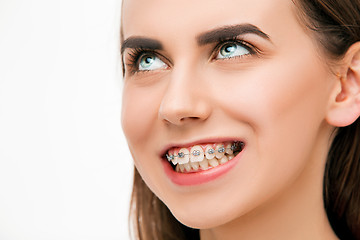 Image showing Beautiful young woman with teeth braces