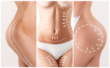 Image showing The cellulite removal plan. White markings on young woman body