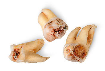 Image showing Closeup three teeth with caries