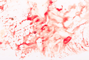 Image showing blood on white