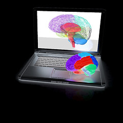 Image showing creative three-dimensional model of real human brain and scan on